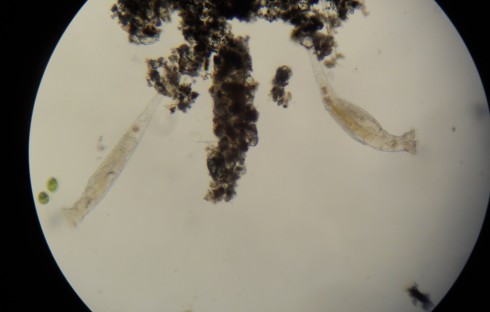Rotifers under the microscope.