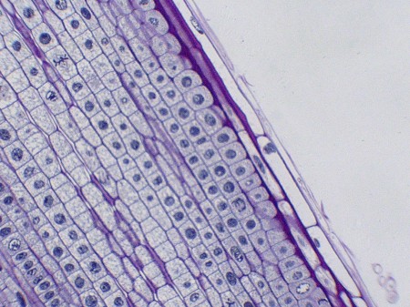 Onion root tip cells,